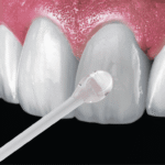 909 Sticky Applicators 50s